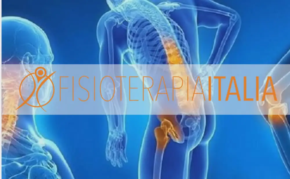 Artrosi e terapia di gruppo in acqua