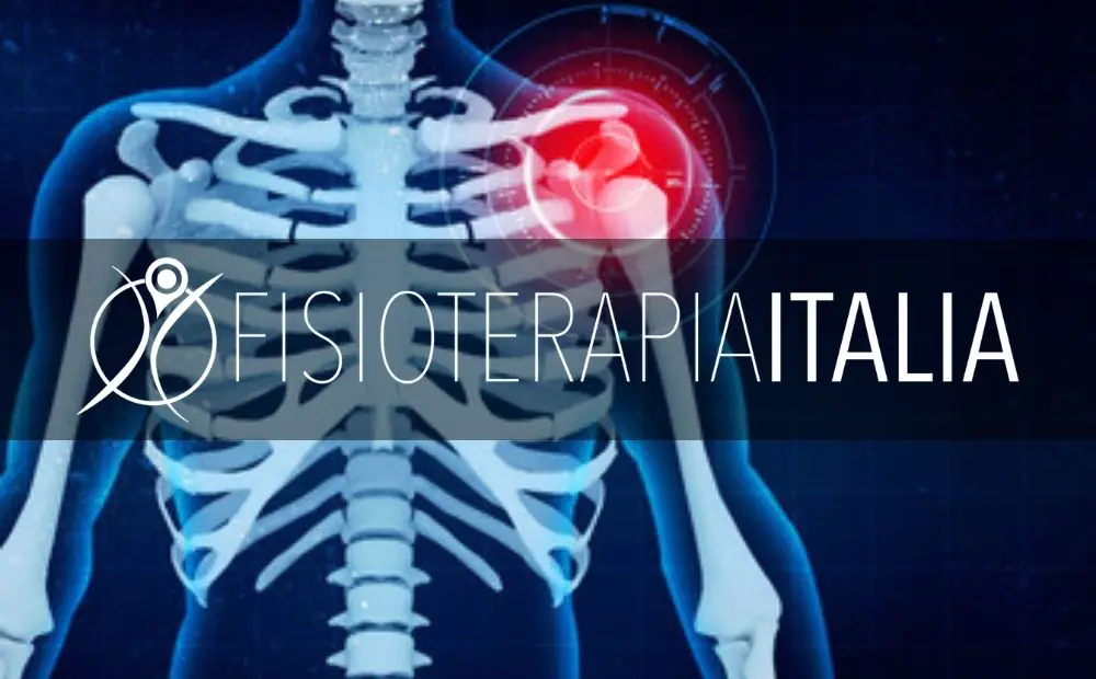 Borsite alla spalla cos'è e come si cura con la fisioterapia
