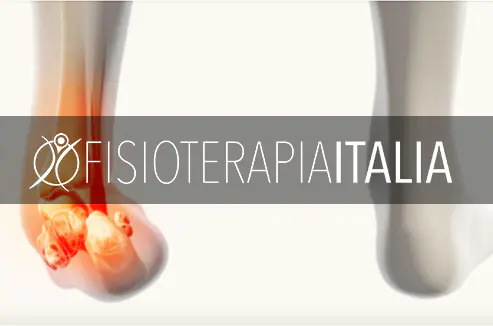 Trattamento fisioterapico della distorsione alla caviglia