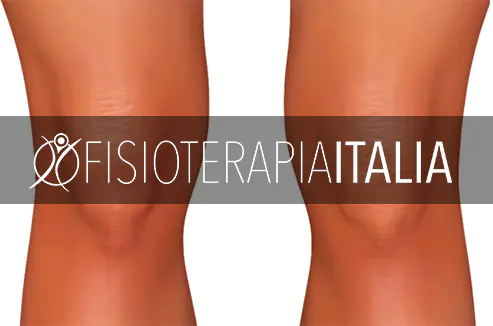 Dolore al ginocchio, da cosa dipende e cosa fare