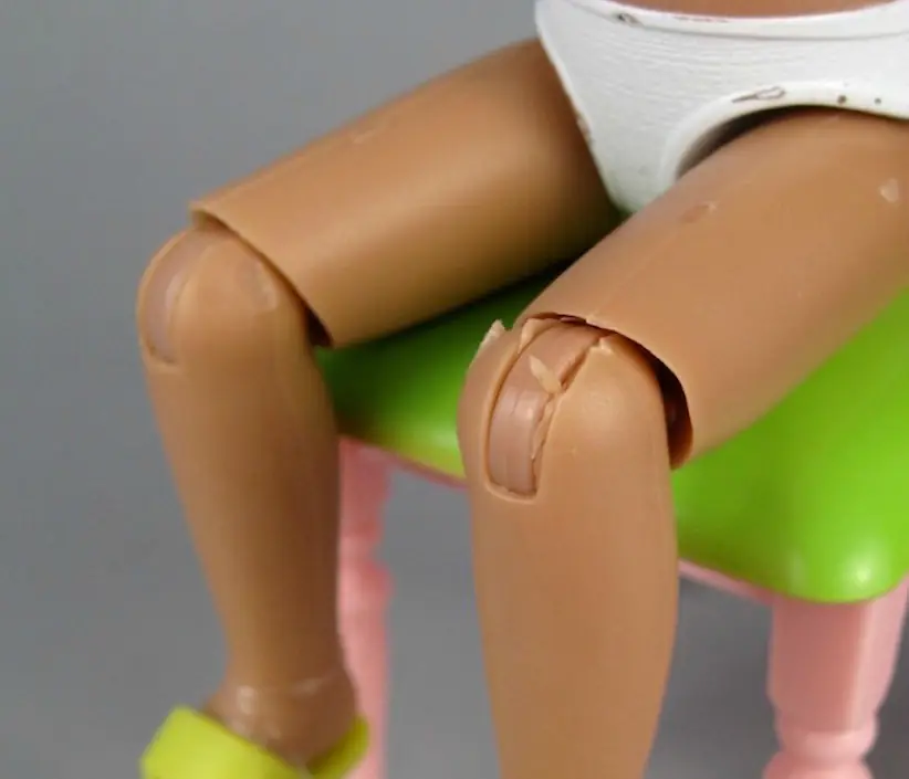 Ginocchio e fisioterapia dopo operazione LCA