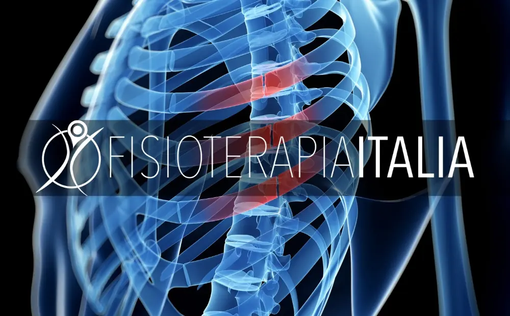 Frattura delle costole: cosa fare e tempi di recupero