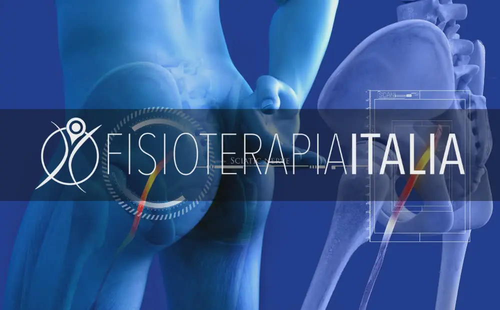 Lombosciatalgia cause e rimedi