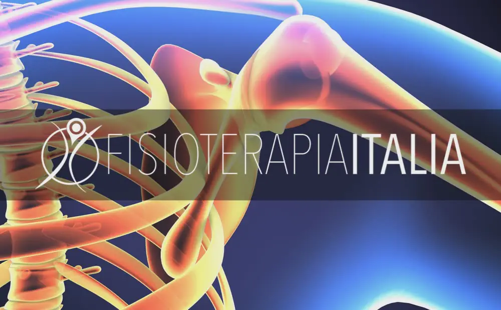 Periartrite scapolo omerale, come affrontare questa patologi...