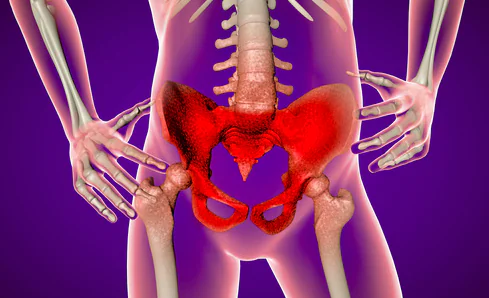 Sintomi in caso di pubalgia cronica o dolore all’ inguine e...