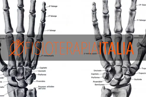 Scafoide, riabilitazione dopo la frattura dell’osso della ma...