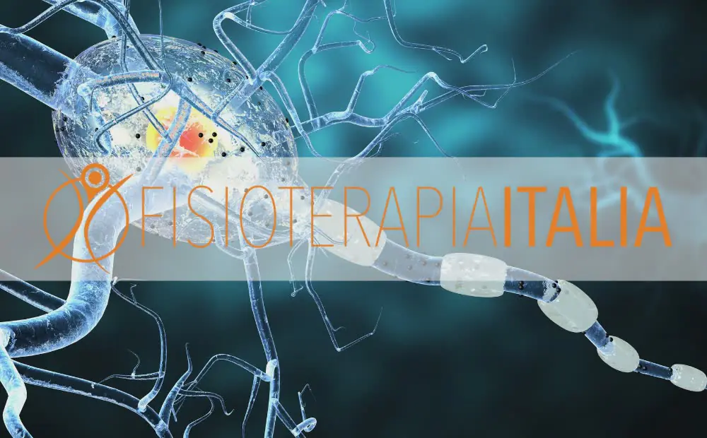 La sclerosi multipla