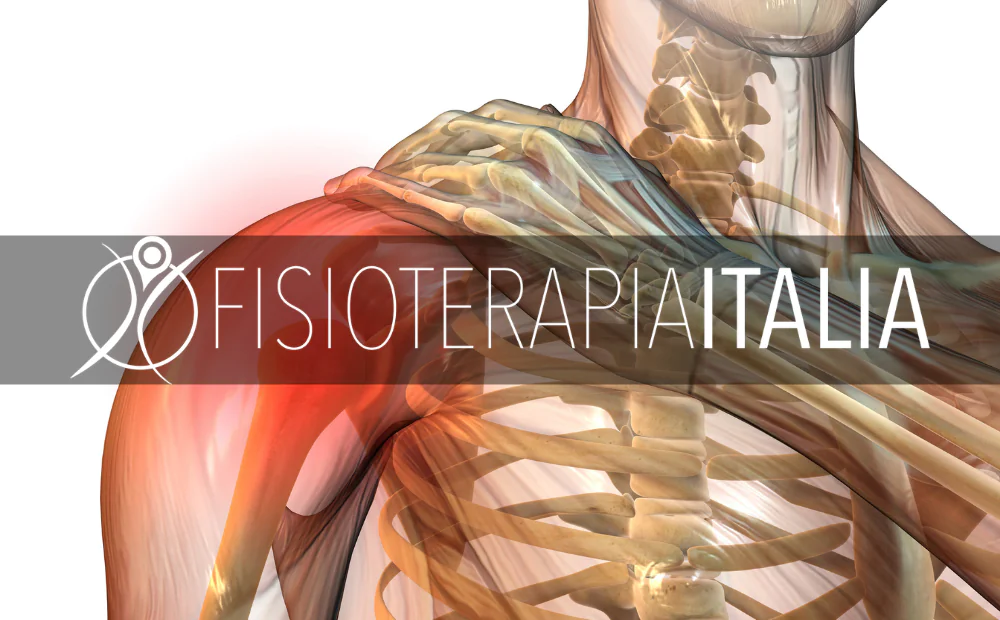 Capsulite adesiva, cos'è e come si cura