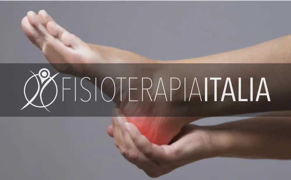 Spina calcaneare Che cos'è quali sono i trattamenti Giusti