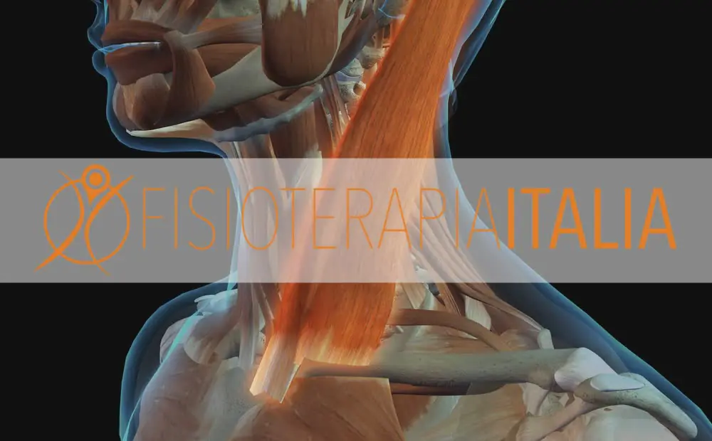 Dolore allo sternocleidomastoideo le cure e i Rimedi